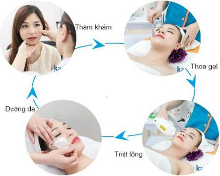 Tẩy lông ria mép mất bao nhiêu lâu thì cho hiệu quả vĩnh viễn?