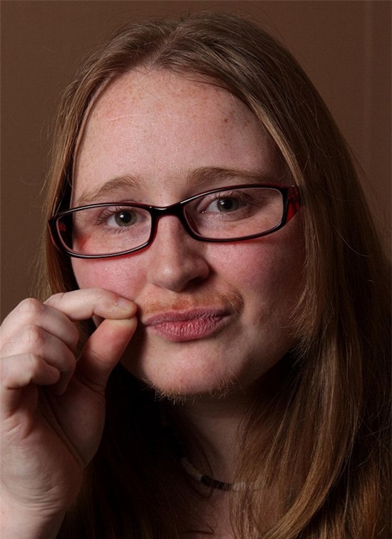 Làm thế nào để triệt ria mép cho nữ?