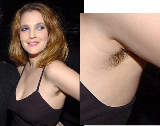 Làm sao để triệt lông nách tận gốc mà an toàn cho da?