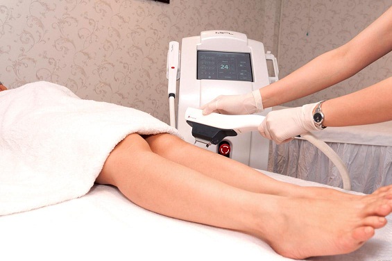 Công nghệ triệt lông vĩnh viễn mới được chị em yêu thích