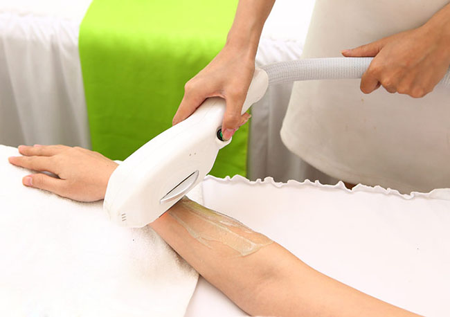 Vì sao nên chọn triệt lông hiện đại thay vì phương pháp “thủ công”?