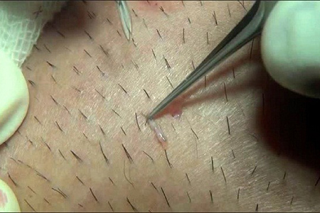 Có nên nhổ lông nách sau khi sinh?