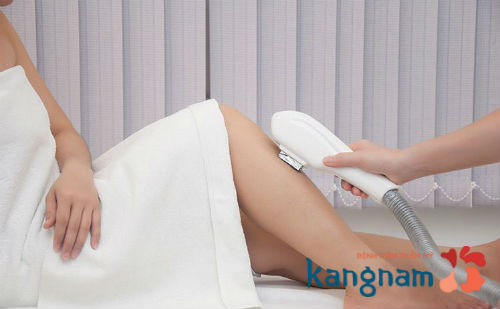 Có nên triệt lông vĩnh viễn không? Đánh giá từ Chuyên Gia thẩm mỹ