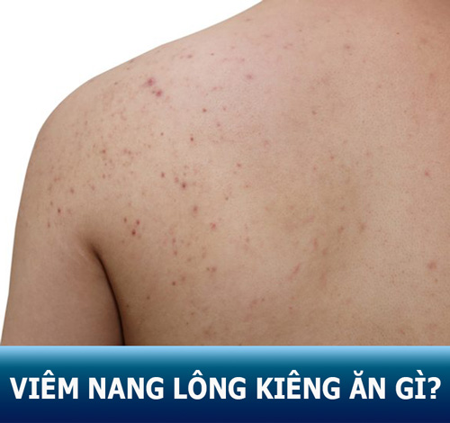 Bị viêm nang lông KIÊNG ĂN và NÊN ĂN gì để nhanh hồi phục?