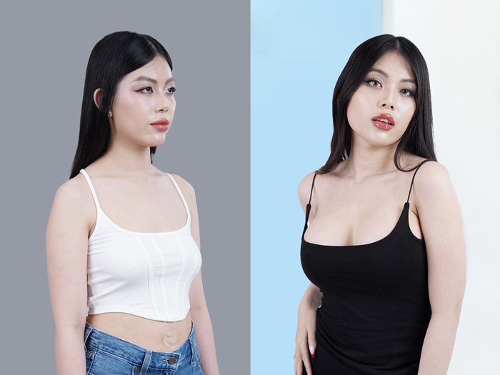 Kangnam có đội ngũ bác sĩ thẩm mỹ giỏi chuyên môn